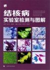 结核病实验室检测与图解 封面