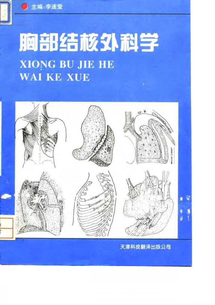 胸部结核外科学 封面