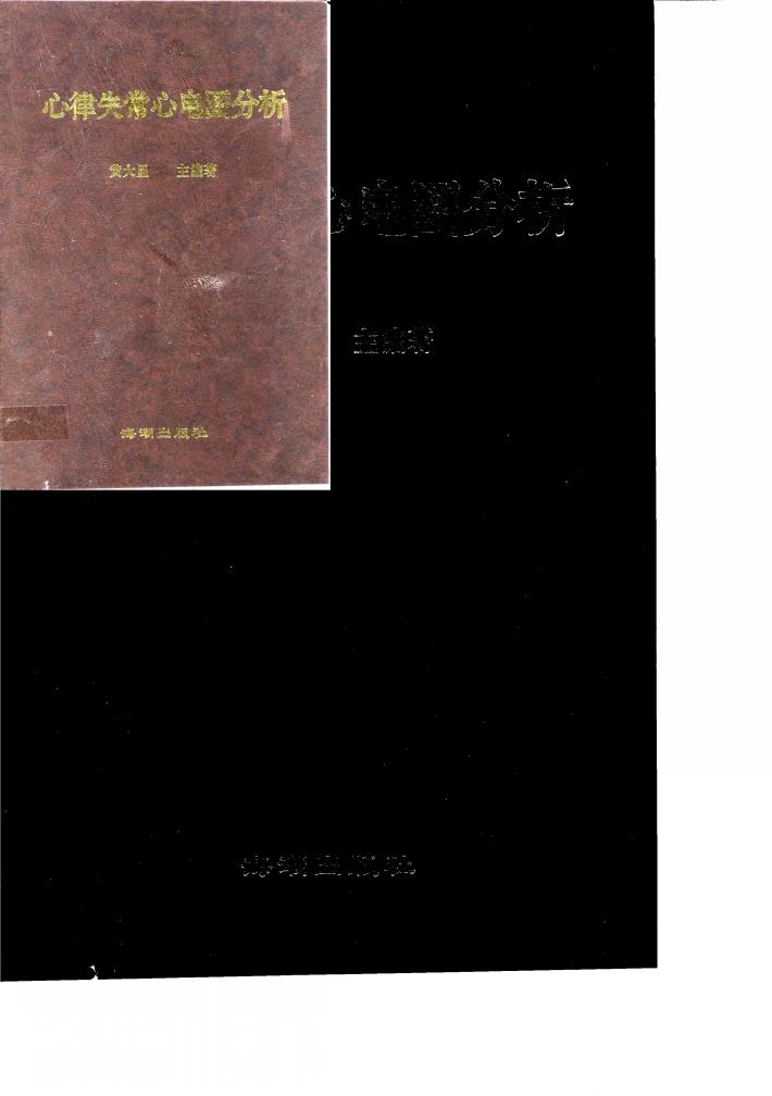 心律失常心电图分析 封面