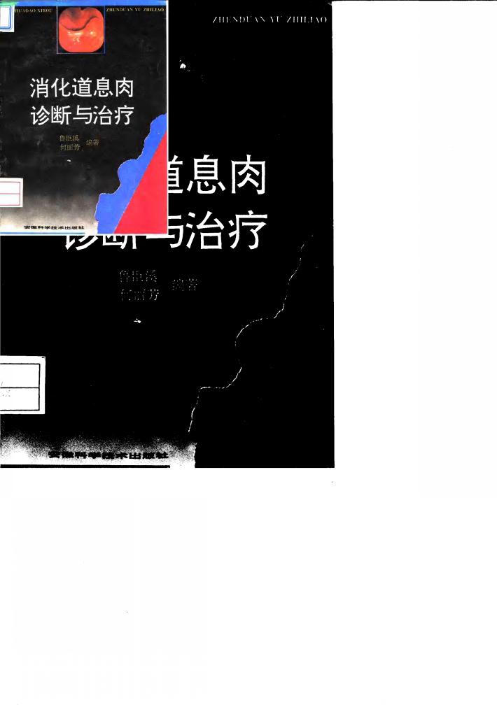 消化道息肉诊断与治疗 封面