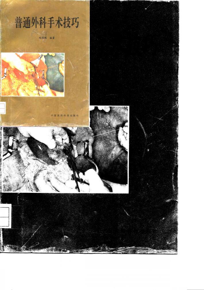 普通外科手术技巧 封面