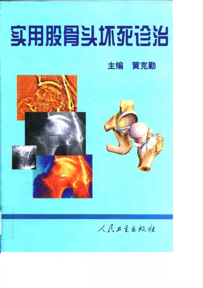 实用股骨头坏死诊治 封面