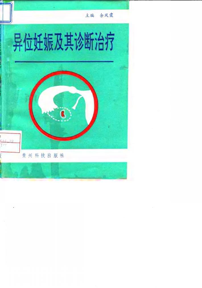 异位妊娠及其诊断治疗 封面