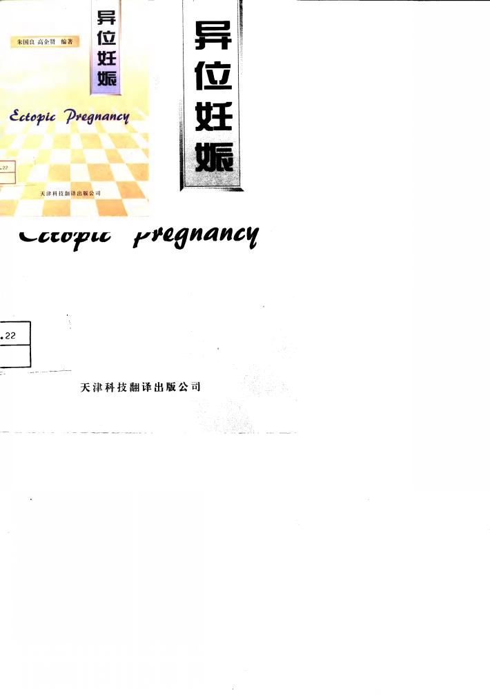 异位妊娠 封面