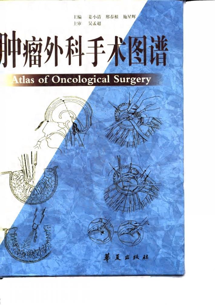 肿瘤外科手术图谱 封面