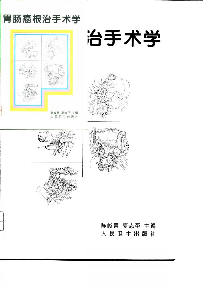 胃肠癌根治手术学 封面