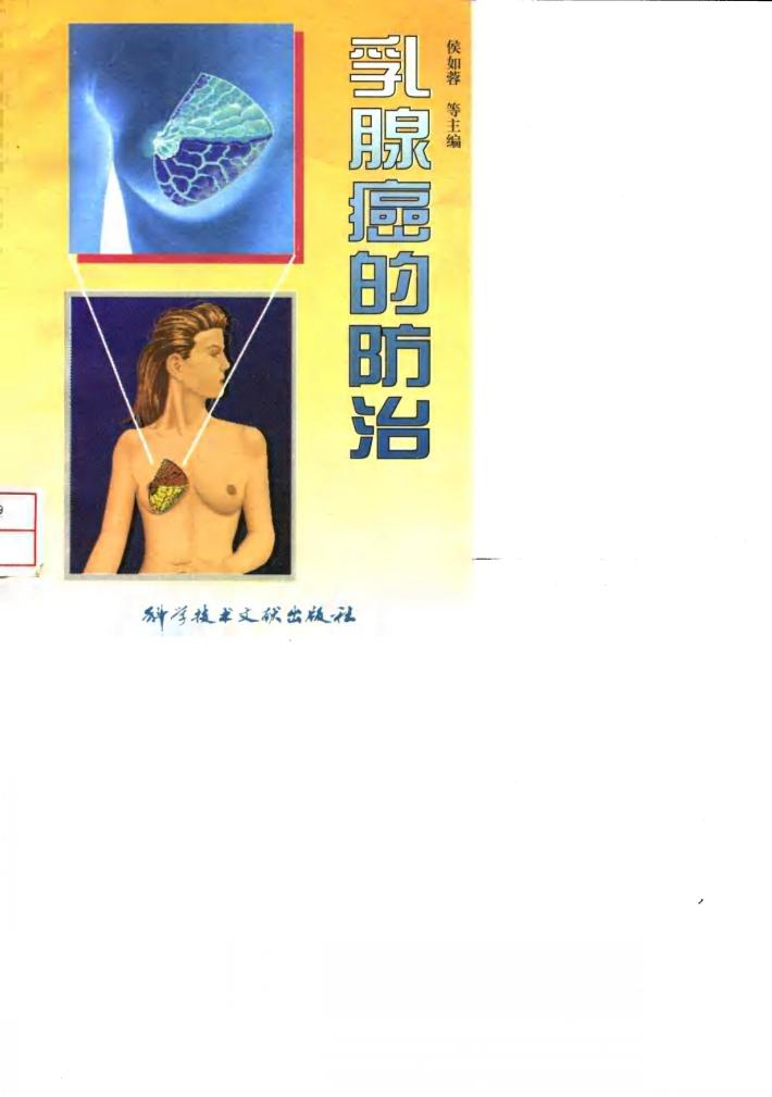 乳腺癌的防治 封面