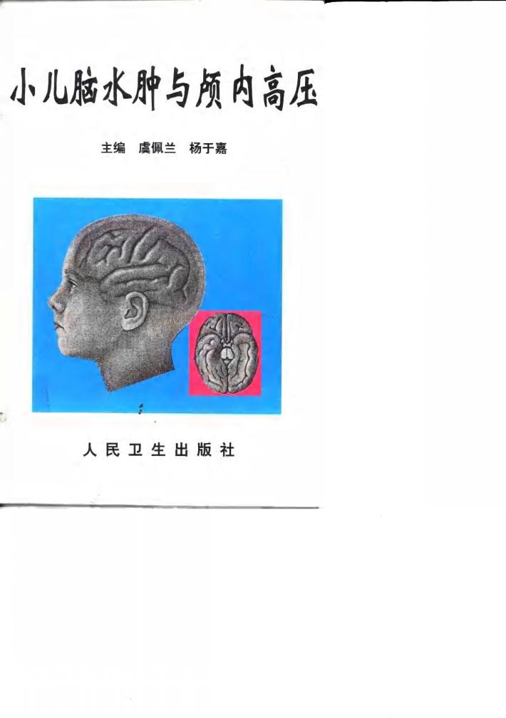 小儿脑水肿与颅内高压 封面