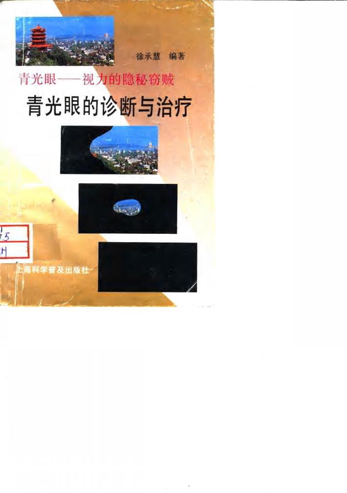 青光眼诊断与治疗 封面