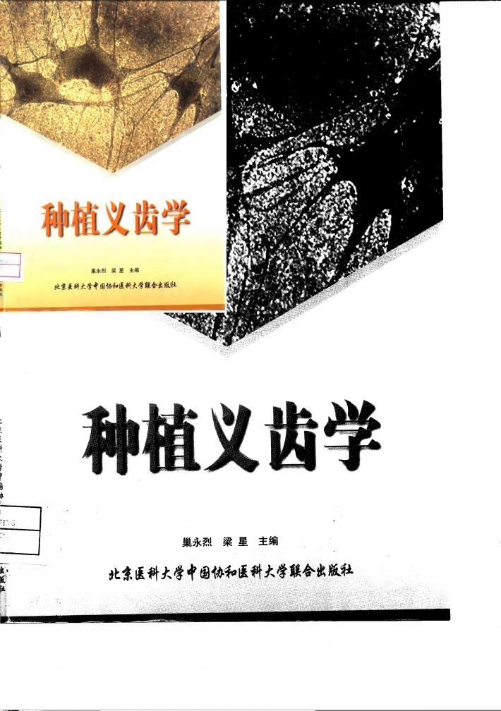 种植义齿学 封面