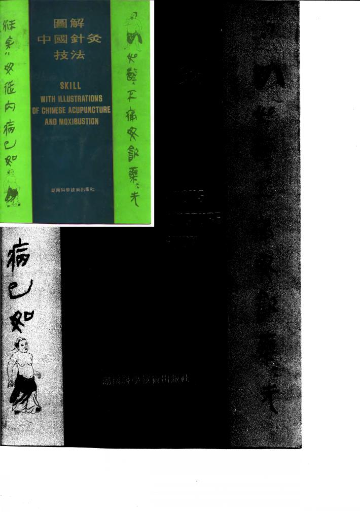 图解中国针灸技法 封面