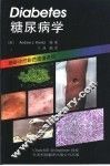 糖尿病学 封面