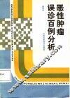 恶性肿瘤误诊百例分析 封面