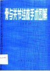 骨与关节结核手术图解 封面