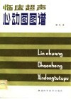 临床超声心动图图谱 封面