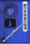 眼内疾病超声图谱 封面