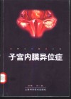 子宫内膜异位症 封面