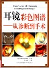 耳镜彩色图谱  从诊断到手术