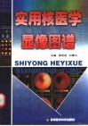 实用核医学显像图谱 封面