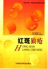 红斑狼疮 封面