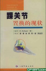 踝关节置换的现状 封面