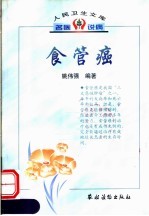 食管癌 封面