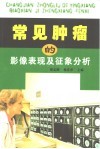 常见肿瘤的影像表现及征象分析 封面