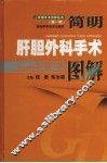 简明肝胆外科手术图解 封面