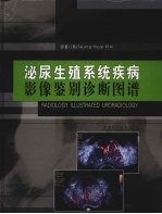 泌尿生殖系统疾病影像鉴诊断图谱 电子书封面