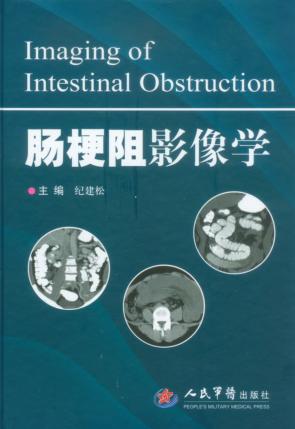 肠梗阻影像学 封面