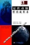 冠状动脉腔内成形术 封面