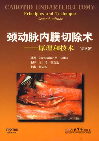 颈动脉内膜切除术  原理和技术 封面