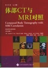 体部CT与MRI对照 上 第4版 封面