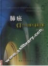 肺癌CT介入诊断与鉴别诊断 封面