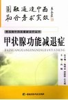 甲状腺功能减退症 封面