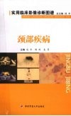 颈部疾病 封面