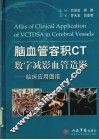 脑血管容积CT数字减影血管造影 封面