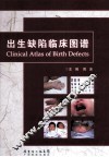 出生缺陷临床图谱 封面