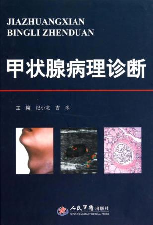 甲状腺病理诊断 封面