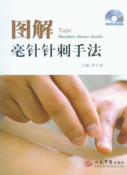图解毫针针刺手法 封面