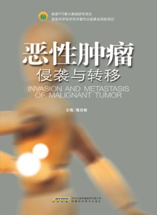 恶性肿瘤侵袭与转移 封面