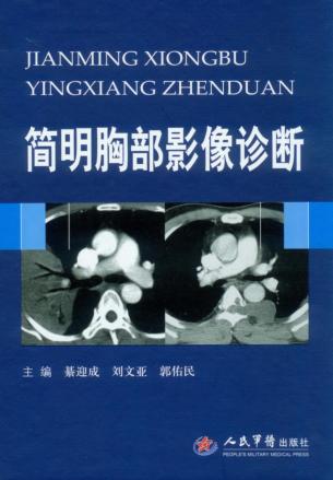 简明胸部影像诊断 封面