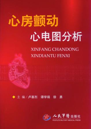 心房颤动心电图分析 封面