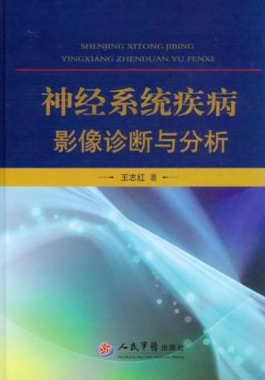 神经系统疾病影像诊断与分析 封面