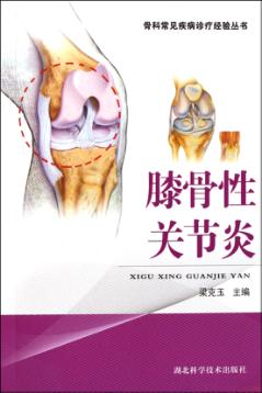 膝骨性关节炎 封面