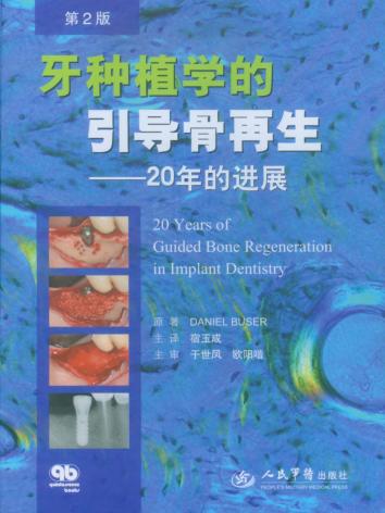 牙种植学的引导骨再生  20年的进展 封面