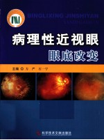 病理性近视眼眼底改变 封面