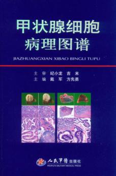 甲状腺细胞病理图谱 封面