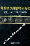 骨肿瘤及肿瘤样病变的CT、MRI读片精粹 封面