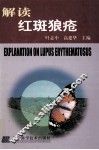 解读红斑狼疮 封面